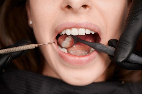 Reasons Your Dentist Cares About Your Diet More Than You Think  2 Sugar And Carbohydrates Fuel Cavities